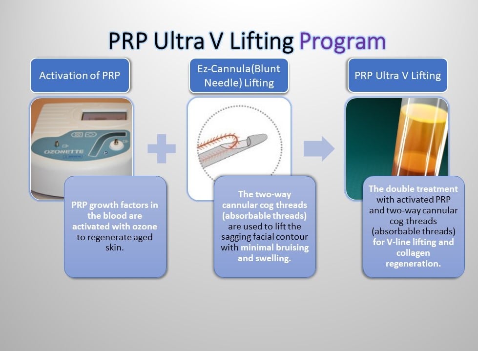 PRP Ultra V Lifting Program