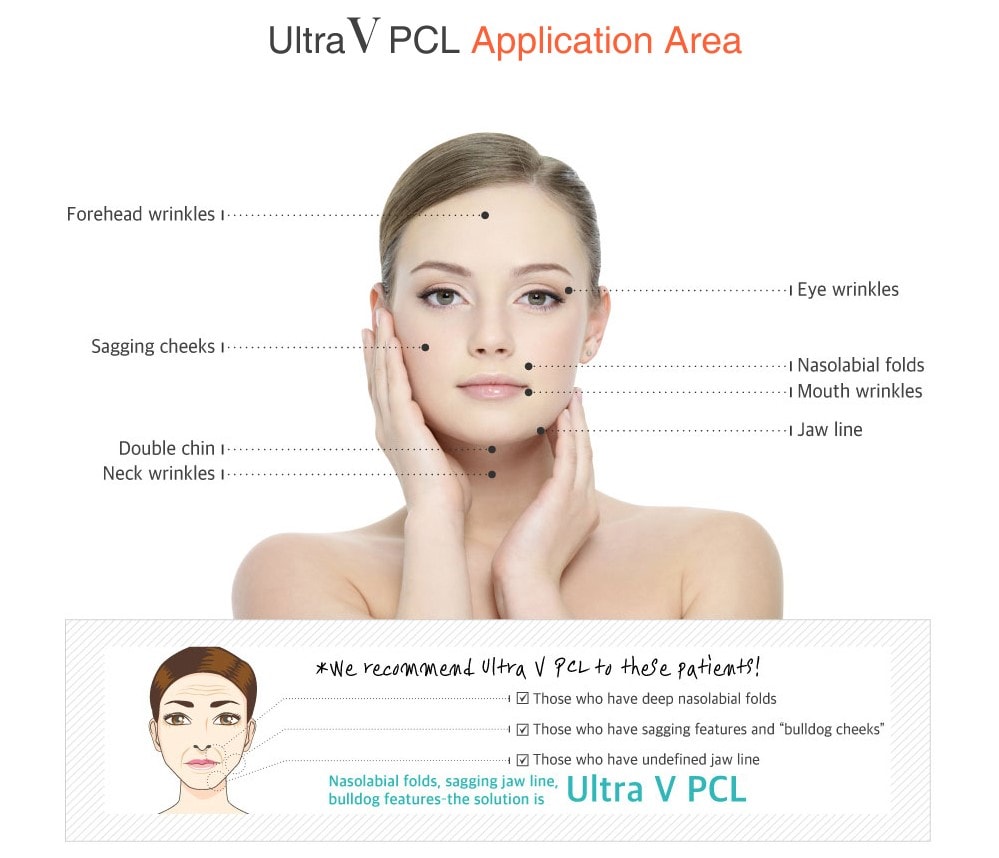 Ultra V PCL Application Area