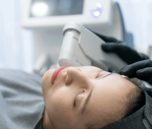 High-frequency focused ultrasound (HIFU) has been used extensively as a minimally invasive way to treat certain forms of cancer. HIFU can also be used safely and effectively in medical aesthetic treatments to achieve anti-aging effects on the face and neck. At American Regenerative Clinic, we offer Ultra V HIFU Lifting, which firms and tightens skin, reducing the effects of aging without surgery. Here are five facts to know about Ultra V Face Lift. Ultra V Lift with HIFU Works by Damaging Cells While damaging cells around the face doesn't sound like a good idea, in fact, the damage helps stimulate the growth and regeneration of collagen fibres and new cells. HIFU targets the layers of the skin below the surface. It does so by heating cells rapidly, which causes damage. The damage triggers collagen fiber production, which provides added structure and elasticity to the skin. The Treatment is Painless HIFU is delivered directly through the top layers of skin, without needles or incisions. No anesthetics or numbing cream is needed. After the 15-30 minute procedure, patients sometimes feel mild stiffness or throbbing, which soon dissipates. Recovery Time is Short Unlike surgery, after which the recovery time for incisions to heal can take weeks or months, there is virtually no downtime after Ultra V HIFU Lift treatments. Because HIFU does not damage the surface of the skin, routine activities such as washing the face and applying makeup are still possible. The Effects are Noticeable Immediately Most patients see a difference in the appearance of their skin immediately after treatment. Skin is firmer and smoother. Over the next few weeks, patients may feel a tightening sensation as collagen regenerates. The full result is realized one to three months after treatment. Ultra V HIFU has Lasting Effects Most patients find that the face lifting effects of HIFU last about six months. However, the result can vary depending on the overall condition of the skin. Repeated treatment every six months to one year will keep skin looking younger and healthier. Ultra V HIFU face lifting is a fast, effective and painless alternative to surgery for patients experiencing some sagging or sinking of the skin. Call us for a consultation to learn whether Ultra V HIFU Face Lifting is the right procedure for you.